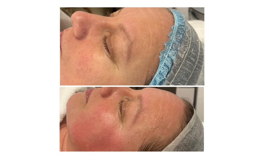 Image 10: Limpieza de cutis manual con tratamiento a elegir para 1 persona