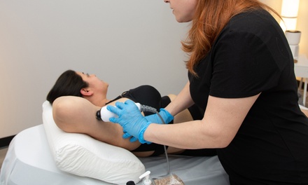 30-Minute 4 Custom Ultrasonic Cavitation Fat Removal Treatments - Precision Frequency Body Sculpting