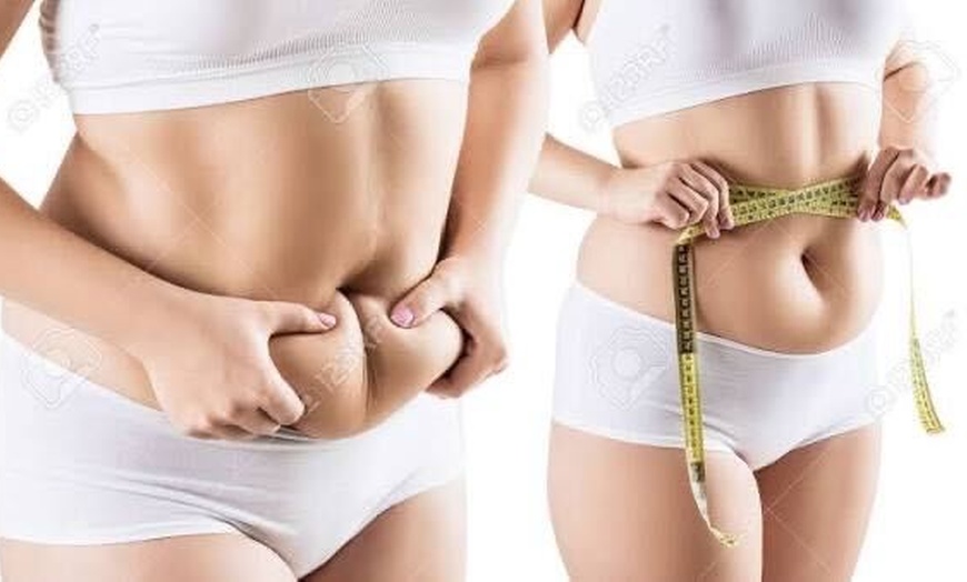 Image 2: Laser Lipo Packages offering a tailored body contouring experience