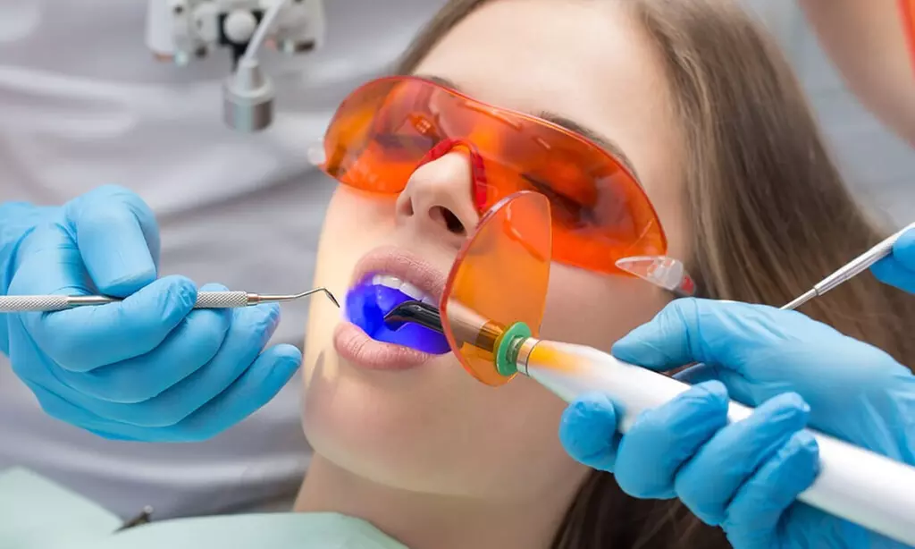 Limpieza bucal con revisión y pulido, y opción a blanqueamiento led