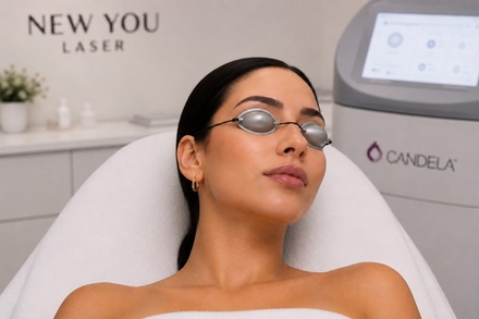 One Laser Facial/Laser Tightening and Rejuvenation for Full Face - New You Laser