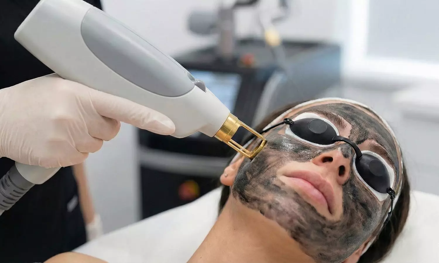 Luce un rostro radiante con 1 o 2 sesiones de peeling Hollywood para una persona - Primary Image