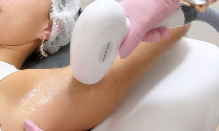 Depilación láser, peeling Hollywood y láser de picosegundos