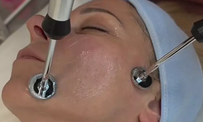 Revitalize your skin: 1x, 3x, or 5x RF Micro-Needling Facial (60-Min)