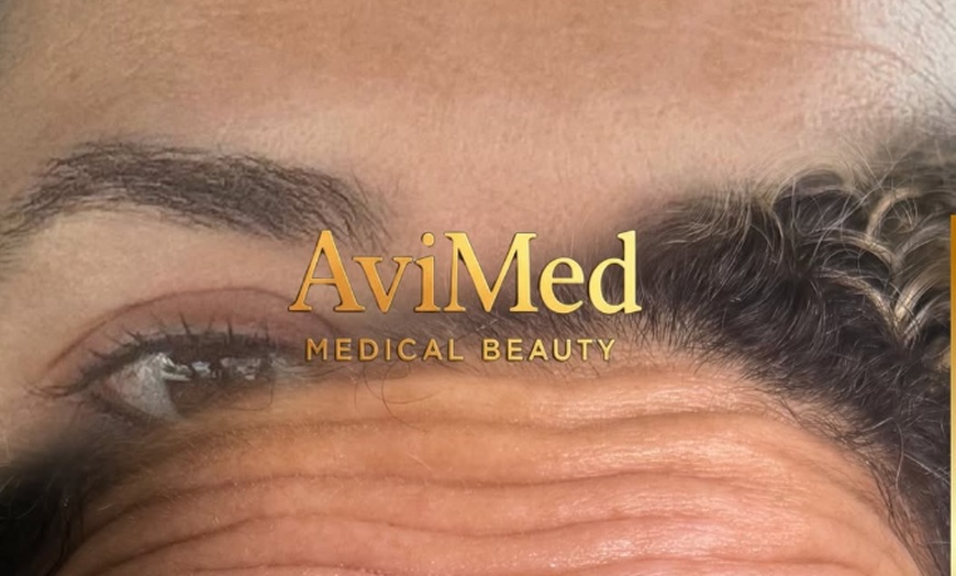 Image 5: Botox Units for Forehead Lines Crow Feet and Full Face Smoothing