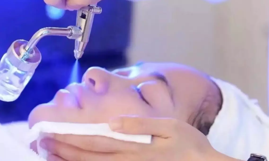 Get One or Three 75-minute Oxygen Infusion Facials at Jessie Beauty Clinic - Primary Image