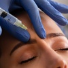 Image 3: Up to 27% Off on Injection - Xeomin at IVE MEDICAL SPA