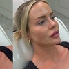 Image 2: Boost Hair and Skin Health with PRP Facial