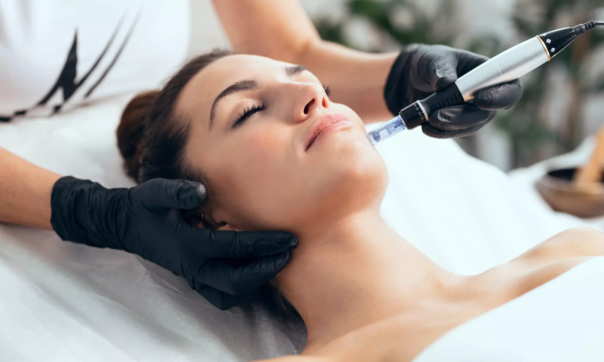 Revitalize with Micro needling Facial Rejuvenation Treatment with HA, PRP, or PDRN Up to 70% Off - Primary Image