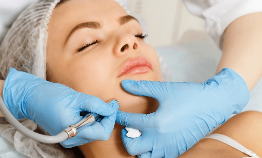 Image 1: Peeling facial biorrevitalizante con opción a papada y cuello