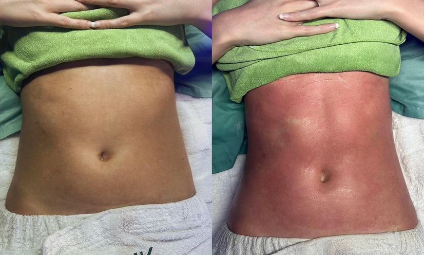 Image 1: 60-Min Lymphatic Massage or 60- or 90-Min Tummy Tightening