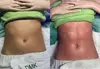Get 1 or 2 Body Sculpting, Cellulite Reduction & Lymphatic Drainage Massage @ Evolutionary Skin(Up To 60% Off)