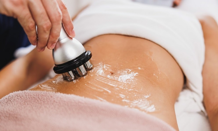 Image 4: Radiofrecuencia facial o corporal por zona, 1 o 2 sesiones