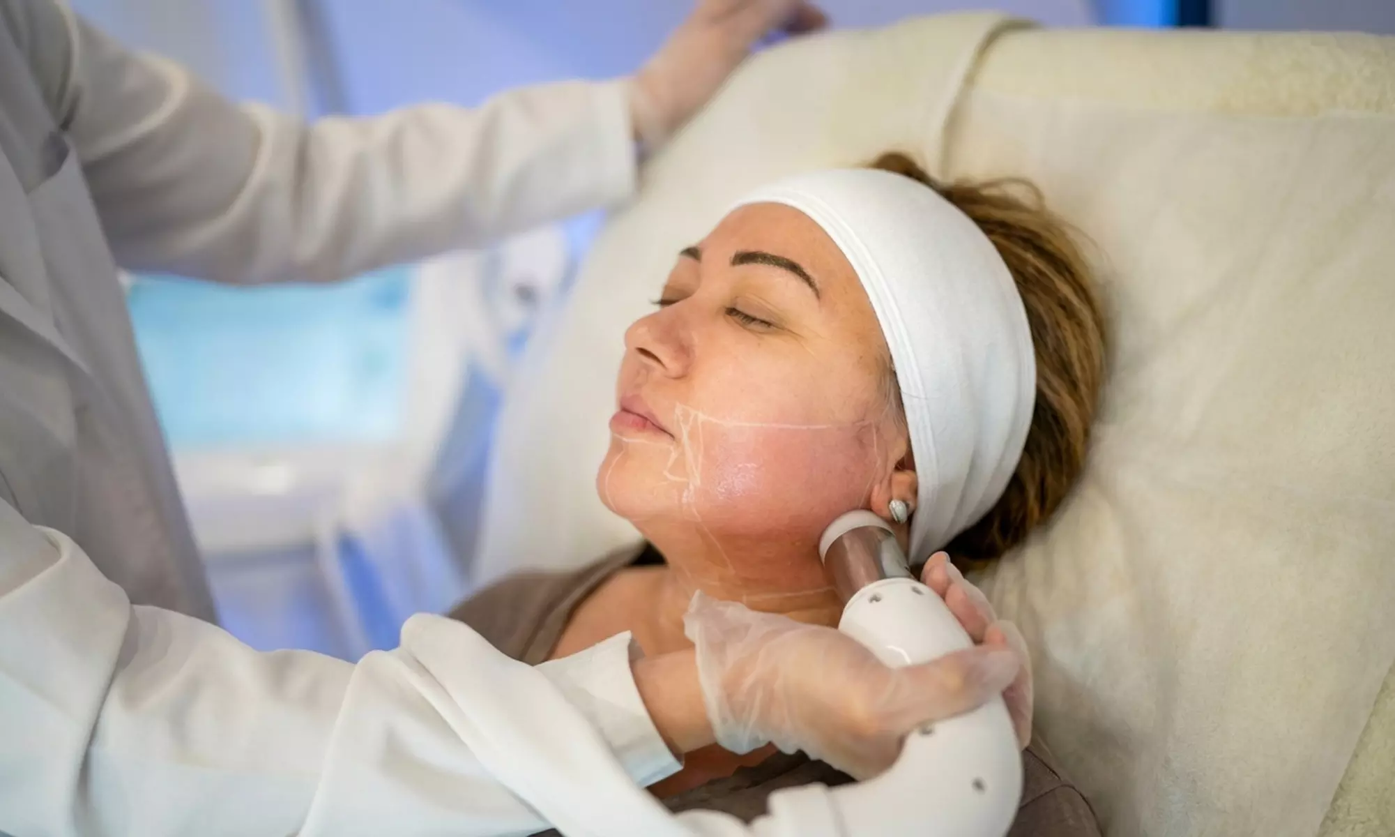 One or Two Sessions of Full Face HIFU Treatments at Abeautys (Up to 62% Off) - Primary Image