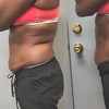 Image 3: Body Contouring Sessions & Packages – Single, Multi-Session, or Duo