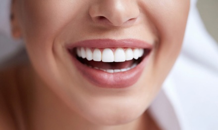 Option 1: 1 Ceramic Veneer - Your Covina Family Dentistry