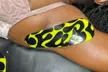 Experience Smooth Skin: One, Three, Five or Ten Brazilian Sugaring Sessions at Sugar & Skin ( Up to 41% Off ) - Second Medium
