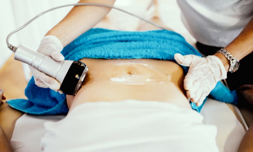 Image 1: 3-Session Slim & Sculpt – 60 Min Body Contouring Series