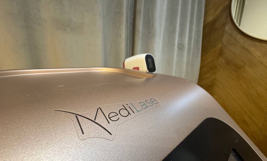 Image 6: Depilacja laserowa Medilase Pro: 1-3 zabiegi na wybrane obszary ciała