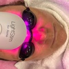 Image 2: Acne Facial at Kimo Bentley
