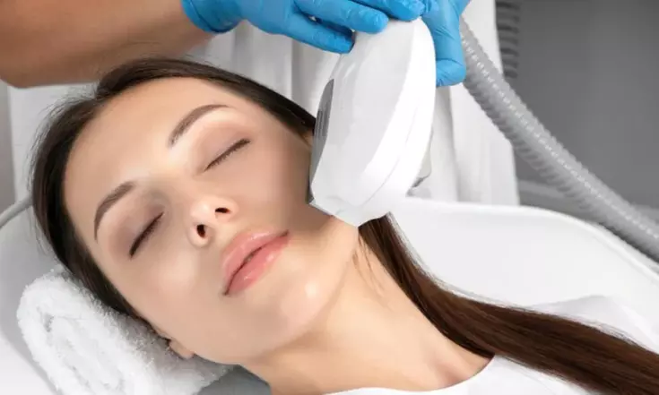 1 o 3 sesiones de láser IPL facial para eliminación de manchas para 1