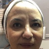 Image 4: Ultrasonic Cavitation and HIFU for Various Body Areas