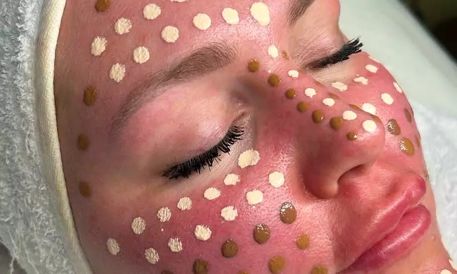 Strahlende Haut ohne Make-up: BB Glow-Gesichtsbehandlung oder Aquapeel Hydra Pur für 1 Person (bis 45% sparen) - Primary Image