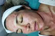 RC Holistic Hands Spa offers various PRP facial options, up to 83% off, for radiant skin - Second Medium