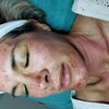 Image 3: Experience rejuvenation with PRP facial treatments