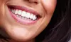 Up to 50% Off on Teeth Whitening at Lux Glo Up Spa