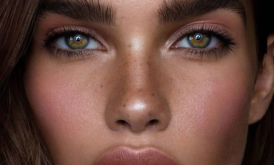 Image 1: Smooth, plump, and refreshed – now enjoy up to 33% off Filler!