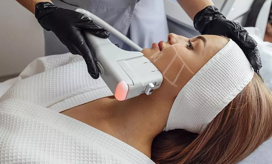 Image 3: 1 o 2 sesiones de tratamiento HIFU facial o corporal para 1 63% 