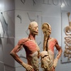 Image 1: REAL BODIES at Horseshoe Las Vegas – Discover the Human Body Like Never Before 