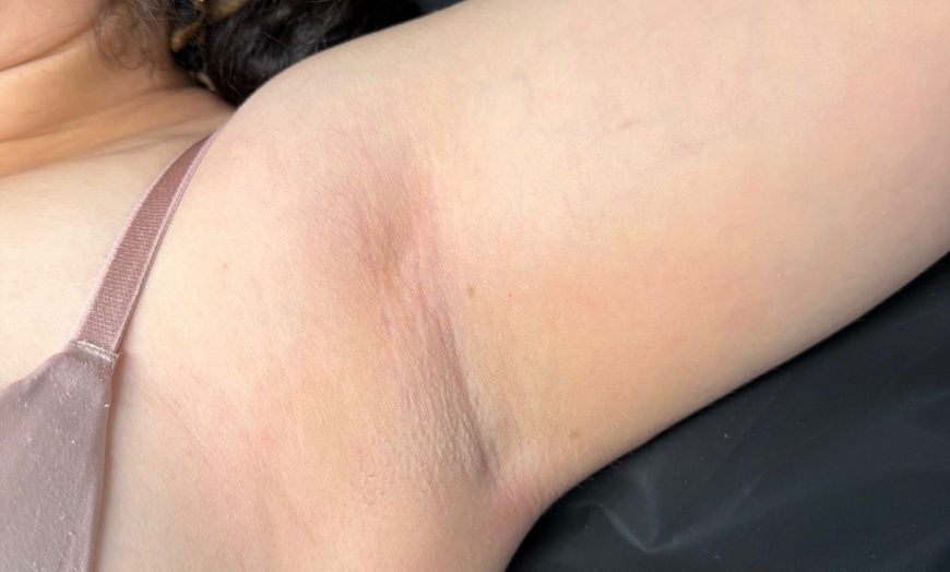 Image 5: Women’s Brazilian, Back & Full Leg Waxing for Smooth Skin