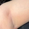 Image 5: Women’s Brazilian, Back & Full Leg Waxing for Smooth Skin