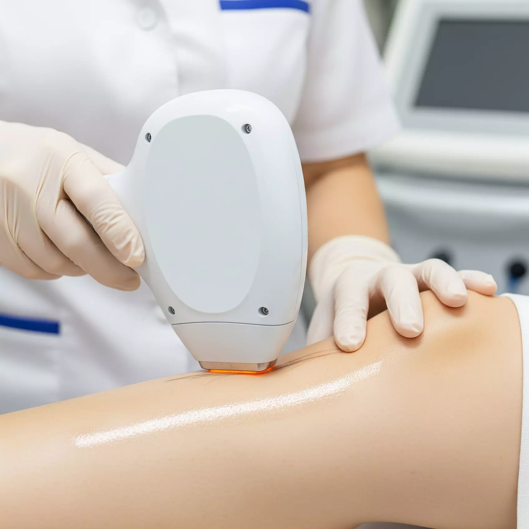 Six Laser Hair Removal Sessions on One Small, Medium, or Large Areas