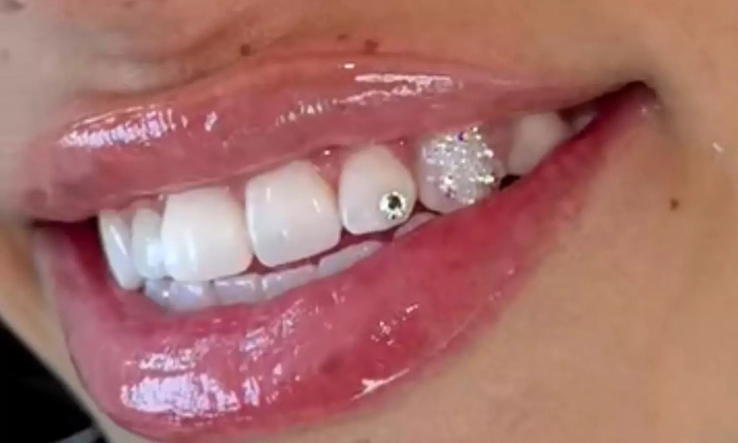 Zahnschmuck mit Swarovski®-Kristallen, Lash- oder Brow-Lifting + Farbe