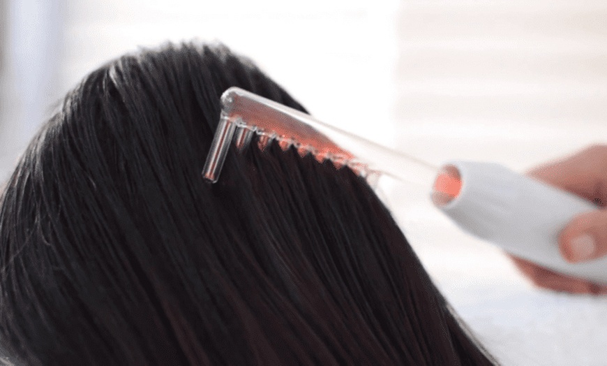 Image 5: Tratamiento capilar regenerativo con alta frecuencia