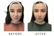 Face-Slim – Non-Invasive Facial Fat Reduction & Contouring at Your Sculpt Studio in Washington, DC - Second Medium