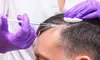 Get 2,3, or 4 PRP Hair Restoration Treatments at Frzn Aesthetics - Up to 36% Off