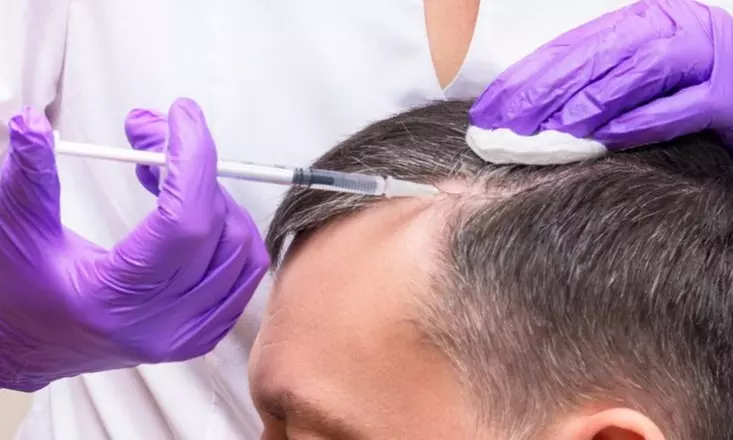 Get 2,3, or 4 PRP Hair Restoration Treatments at Frzn Aesthetics - Up to 36% Off - Primary Image