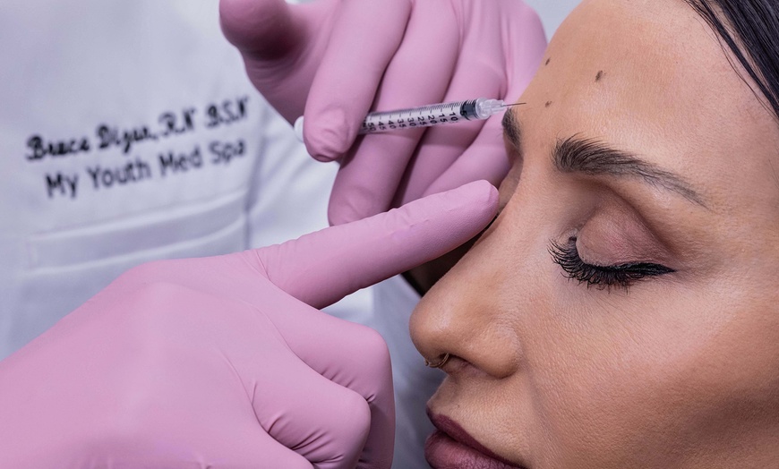 Image 3: Up to 50% Off on Injection - Botox at My Youth Med Spa