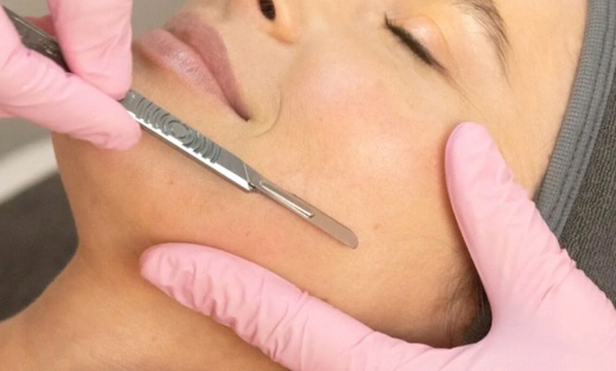 Image 1: Unveil Radiant Skin with One or Three Microneedling & Dermaplaning Facial Sessions