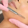 Image 1: Unveil Radiant Skin with One or Three Microneedling & Dermaplaning Facial Sessions