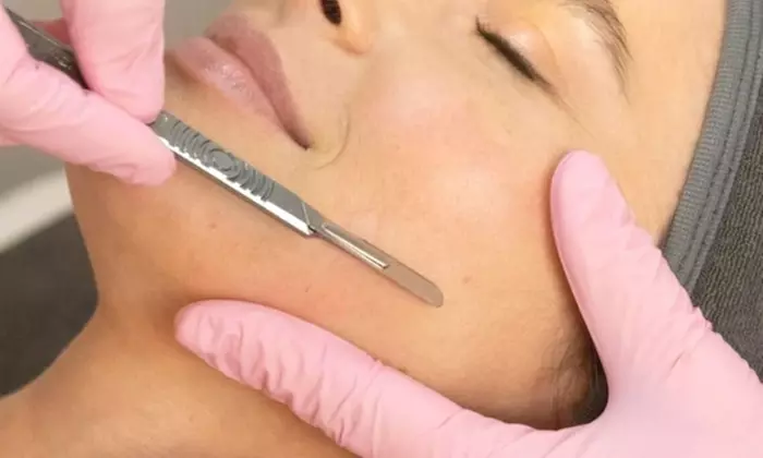 Unveil Radiant Skin with One or Three Microneedling & Dermaplaning Facial Sessions