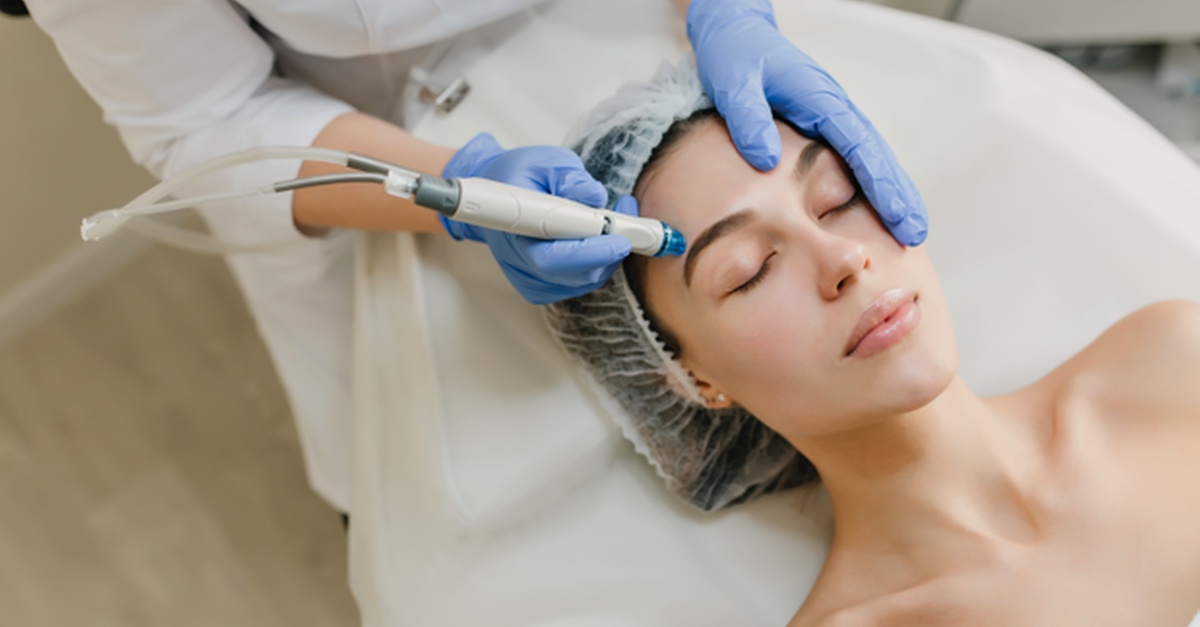 Tratamiento facial con dermapen en Cádiz