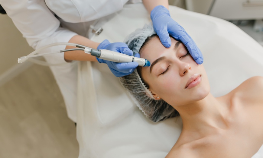 Image 1: Tratamiento facial con dermapen con cóctel de vitaminas o exosomas