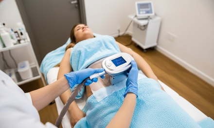 1 séance de cryolipolyse sur 1 zone - JK Santé & Beauté