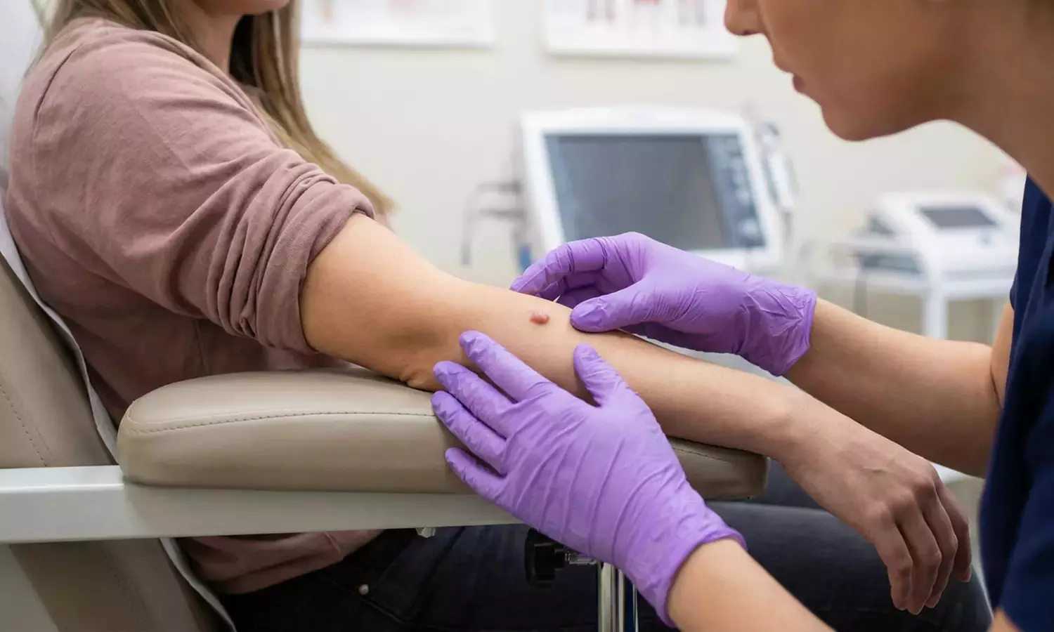 Eliminación de hasta 3, 6 o 10 verrugas, lunares, manchas o puntos rubí con valoración previa hasta un 65% menos - Primary Image