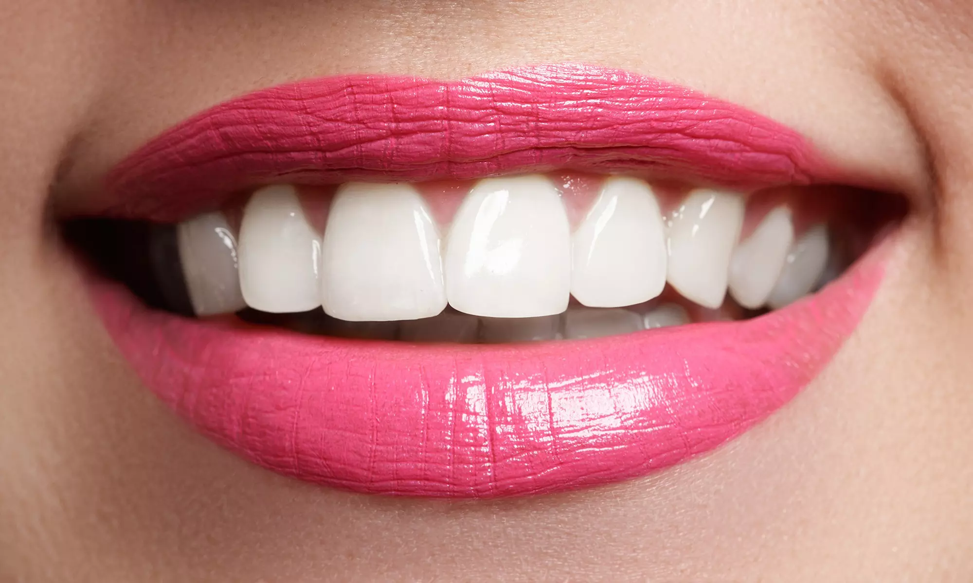 Professional 3D Teeth Whitening Kit w Remineralization Gel: 1 & 2 pack